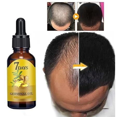 "GingerGrow 7-Day Hair Oil"